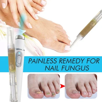 Nail Treatment Pen Anti-fungal Home Treatment Set Toe Onychomycosis Zanokcica Anti-Fungal Fungus Care Repair Serum Kit Dropship